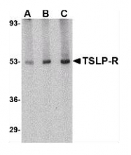 AP07146PU-N - CRLF2
