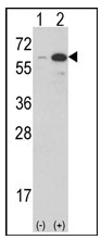 AP14717PU-N - Estrogen-related receptor gamma