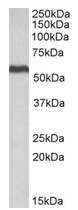 AP22390PU-N - ALDH5A1 / SSADH