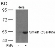 AP08024PU-S - SMAD1