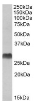 AP22389PU-N - HLA-DQA2
