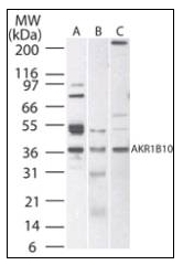 AP08422PU-N - AKR1B10