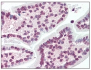 AM20145PU-N - XBP1 / TREB5