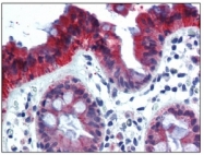 BM2275F - Cytokeratin 18