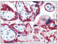 BM2275F - Cytokeratin 18