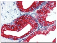 BM2275F - Cytokeratin 18