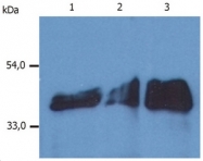SM3044P - Cytokeratin 18