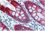 SM3044P - Cytokeratin 18