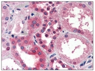 AM20332PU-N - SMAD3