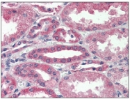 AM20384PU-N - VEGF-A
