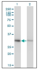 AM20403PU-N - Annexin A4 / ANXA4