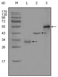 AM20405SU-N - PEG10