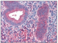 AM20416SU-N - Fibrinogen beta chain