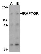 AP07764PU-N - RAPTOR