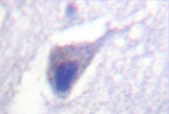 AP06385PU-N - Dynamin-1
