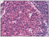 AM20421PU-N - CD195 / CCR5