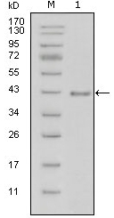 AM20428SU-N - Laminin beta-1 / LAMB1