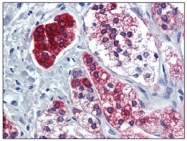 AM20438SU-N - PPAR-gamma