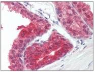 AM20438SU-N - PPAR-gamma