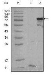 AM20438SU-N - PPAR-gamma