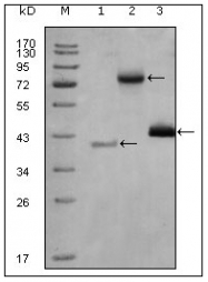 AM20439SU-N - HDAC3