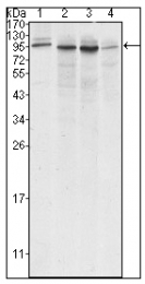AM20453SU-N - Calnexin