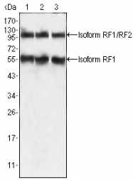 AM20459SU-N - PEG10