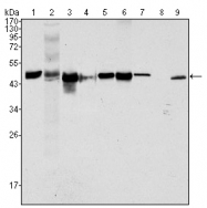 AM20460SU-N - Cytokeratin 18