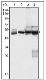 AM20469SU-N - Cytokeratin 7