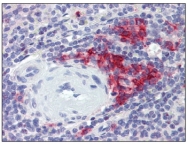 AM20475SU-N - CD38