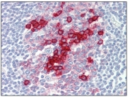 AM20475SU-N - CD38