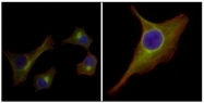 AM20477SU-N - Cytokeratin 15