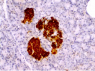 20056 - Insulin