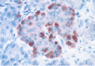 20076 - Glucagon