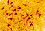 20080 - Serotonin