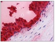 AM20543PU-N - Kallikrein-3 / PSA / KLK3