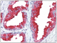 AM20526PU-N - ACPP / Prostatic acid phosphatase