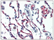 AM20524FC-N - CD34