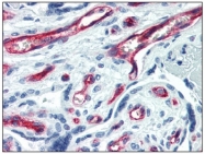 AM20524FC-N - CD34