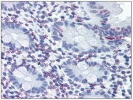 AM20525PU-N - Vitamin D3 receptor / NR1I1