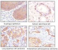 AM20528SU-N - Cytokeratin 5