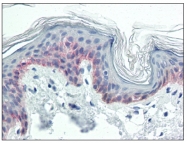 AM20528SU-N - Cytokeratin 5