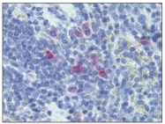 AM20534AF-N - Interleukin-13 / IL13
