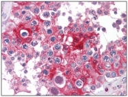 AM20537PU-N - LDHA