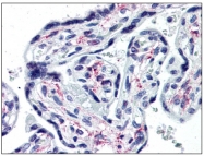AM20494PU-N - CD121a / IL1R1