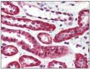 AM20501PU-N - CD221 / IGF1R