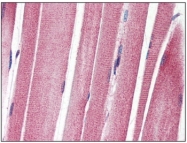 AM20501PU-N - CD221 / IGF1R