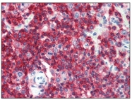 AM20486PU-N - CD45 / LCA