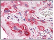 AM20489PU-N - CD88 / C5R1