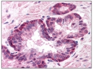 AP07184SU-N - Lamin-A/C (LMNA)